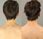 Spray AcnéClear - CORPS | 100ml